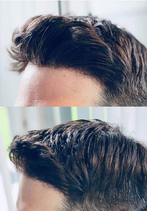 Ultra Thin Skin Toupee UTS 2.0 |Thinnest Hair System Ever 0.02mm Thin Skin V-looped Toupee [ SV02 ]